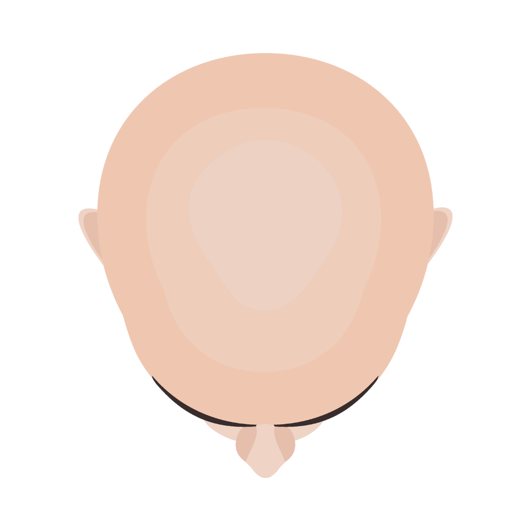 Alopecia extensa