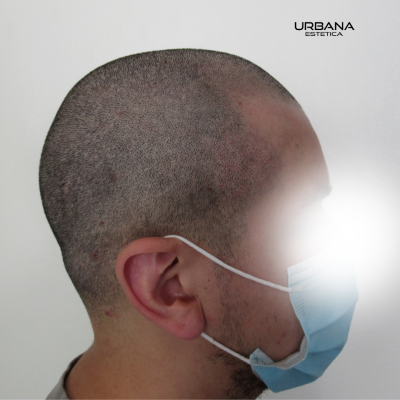 Reconstrucción de entradas